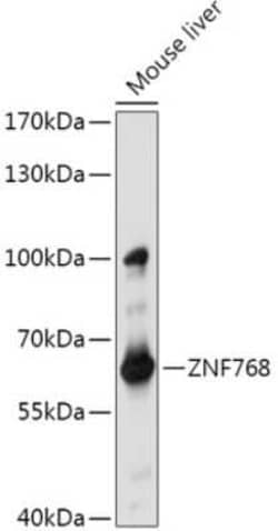 ZNF768 Antibody - Azide and BSA Free, Novus Biologicals:Antibodies:Primary