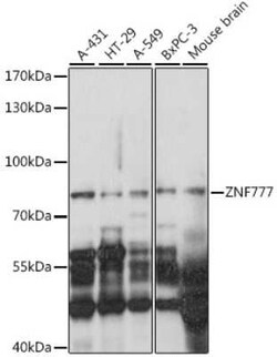 ZNF777 Antibody - Azide and BSA Free, Novus Biologicals:Antibodies:Primary