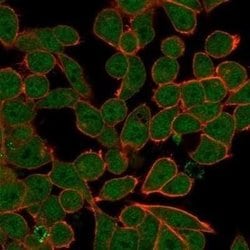 ZNF81 Mouse anti-Human, Clone: PCRP-ZNF81-2C7, Novus Biologicals 20 &mu;g;