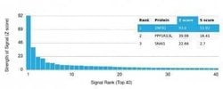 ZNF81 Mouse anti-Human, Clone: PCRP-ZNF81-2C7, Novus Biologicals 20 &mu;g;
