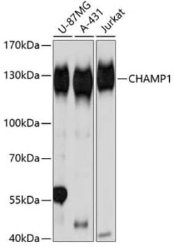 ZNF828 Antibody - Azide and BSA Free, Novus Biologicals 0.02 mL; Unconjugated:Antibodies,