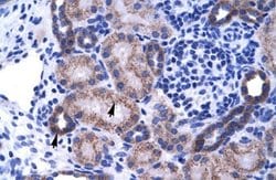 ZNF84 Rabbit anti-Human, Polyclonal, Novus Biologicals 0.1ml; Unconjugated:Antibodies,