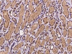 ZNF842 Antibody, Novus Biologicals 100 &mu;g | Buy Online | Novus Biologicals | Fisher Scientific