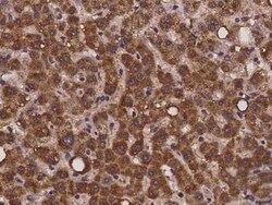 ZNF842 Antibody, Novus Biologicals 100 &mu;g | Buy Online | Novus Biologicals | Fisher Scientific