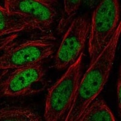 ZNF843 Rabbit anti-Human, Polyclonal, Novus Biologicals 100 &mu;g; Unconjugated:Antibodies,