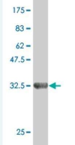 ZNF85 Antibody (4D12), Novus Biologicals 0.1 mg, Unconjugated:Antibodies,
