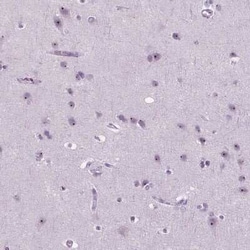 ZNF853 Antibody, Novus Biologicals 25 &mu;L, Unconjugated:Antibodies, Polyclonal