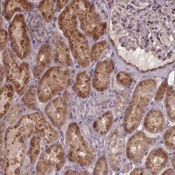ZNF879 Antibody, Novus Biologicals:Antibodies:Primary Antibodies
