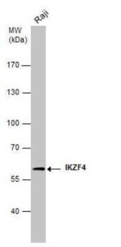 ZNFN1A4 Antibody (GT976), Novus Biologicals 100 &mu;g; Unconjugated:Antibodies,