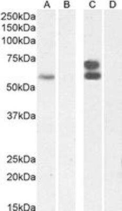 ZNFN1A4 Antibody, Novus Biologicals 100 &mu;g; Unconjugated:Antibodies,