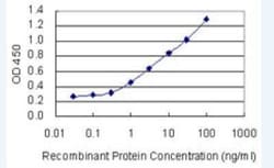 ZNFX1 Antibody (6F9), Novus Biologicals 100 &mu;g | Buy Online | Novus Biologicals | Fisher Scientific
