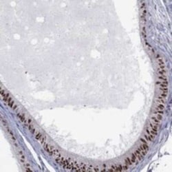 ZNHIT3 Rabbit anti-Human, Polyclonal, Novus Biologicals 25 &mu;g; Unconjugated:Antibodies,