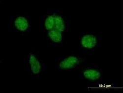 ZNHIT6 Antibody, Novus Biologicals 0.05 mg | Buy Online | Novus Biologicals | Fisher Scientific
