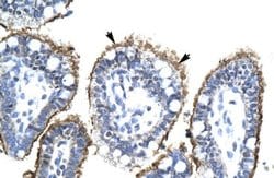 ZNHIT6 Rabbit anti-Human, Polyclonal, Novus Biologicals 0.1ml; Unconjugated:Antibodies,