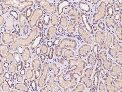 ZP2 Antibody, Novus Biologicals 50 &mu;g, Unconjugated:Antibodies, Polyclonal