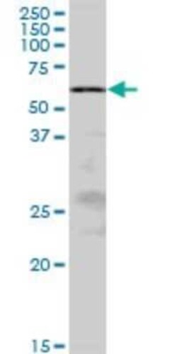 ZRSR2 Antibody, Novus Biologicals 50 &mu;g | Buy Online | Novus Biologicals | Fisher Scientific