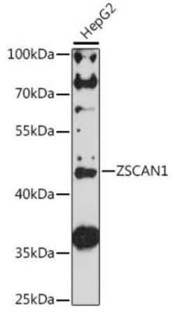 ZSCAN1 Antibody - Azide and BSA Free, Novus Biologicals 0.02 mL; Unconjugated:Antibodies,