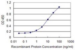 ZSCAN16 Antibody (4A9), Novus Biologicals 0.1 mg | Buy Online | Novus Biologicals | Fisher Scientific