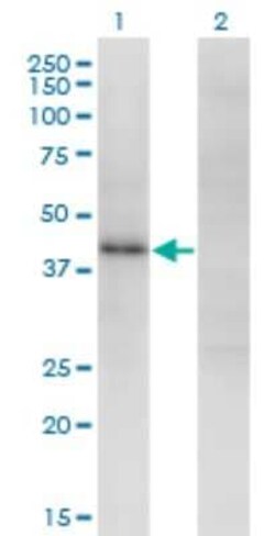 ZSCAN16 Antibody (4A9), Novus Biologicals 0.1 mg | Buy Online | Novus Biologicals | Fisher Scientific