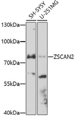 ZSCAN2 Antibody - Azide and BSA Free, Novus Biologicals 0.1 mL, Unconjugated:Antibodies,