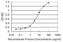 ZSCAN21/ZFP38 Antibody (4B11), Novus Biologicals 0.1 mg | Buy Online | Novus Biologicals | Fisher Scientific