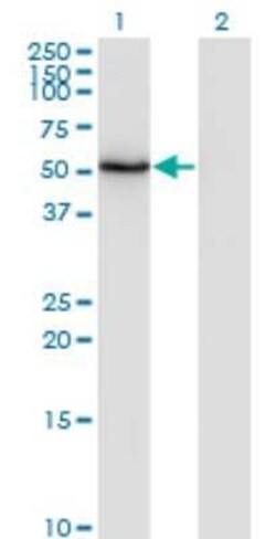 ZSCAN21/ZFP38 Antibody (4B11), Novus Biologicals 0.1 mg | Buy Online | Novus Biologicals | Fisher Scientific