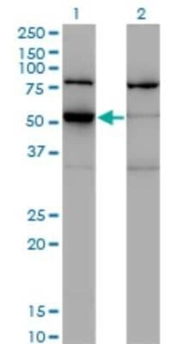 ZSCAN21/ZFP38 Antibody (4B3), Novus Biologicals 0.1 mg | Buy Online | Novus Biologicals | Fisher Scientific