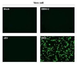 Zika Virus (H/PF/2013) Envelope Antibody (GT363), Novus Biologicals 100 &mu;g | Buy Online | Novus Biologicals | Fisher Scientific