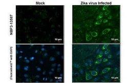 Zika Virus (H/PF/2013) Envelope Antibody (GT363), Novus Biologicals 100 &mu;g | Buy Online | Novus Biologicals | Fisher Scientific
