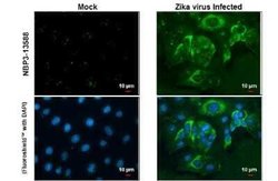 Zika Virus (H/PF/2013) Envelope Antibody (GT871), Novus Biologicals 100 &mu;g | Buy Online | Novus Biologicals | Fisher Scientific