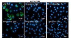 Zika Virus (H/PF/2013) Envelope Antibody, Novus Biologicals 100 &mu;g;