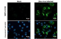 Zika Virus (H/PF/2013) Envelope Antibody, Novus Biologicals 100 &mu;g;