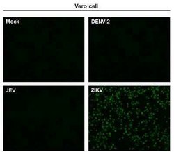 Zika Virus (H/PF/2013) Envelope Antibody, Novus Biologicals 100 &mu;g | Buy Online | Novus Biologicals | Fisher Scientific