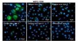 Zika Virus (H/PF/2013) Envelope Antibody, Novus Biologicals 100 &mu;g | Buy Online | Bio-Techne | Fisher Scientific