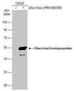 Zika Virus (H/PF/2013) Envelope Antibody, Novus Biologicals 100 &mu;g | Buy Online | Novus Biologicals | Fisher Scientific