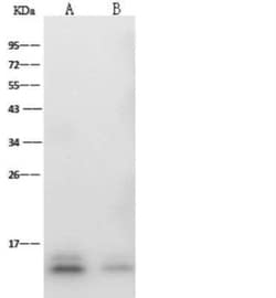 Zika Virus (SPH2015) Envelope Antibody (09), Novus Biologicals 50 &mu;g;