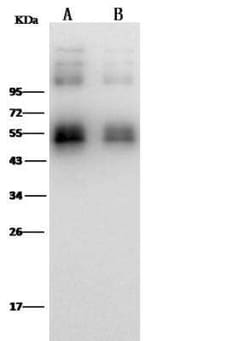 Zika Virus (SPH2015) NS1 Antibody (15), Novus Biologicals:Antibodies:Primary