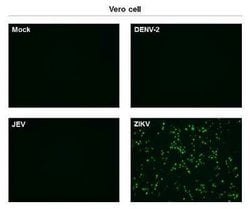 Zika virus (H/PF/2013) NS1 Antibody (GT281), Novus Biologicals 100 &mu;g | Buy Online | Novus Biologicals | Fisher Scientific