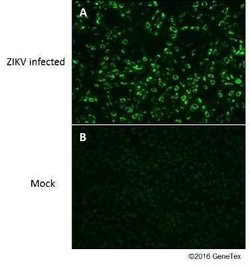 Zika virus (H/PF/2013) NS1 Antibody, Novus Biologicals 100 &mu;g | Buy Online | Bio-Techne | Fisher Scientific
