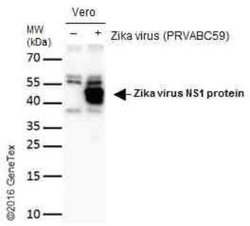 Zika virus (H/PF/2013) NS1 Antibody, Novus Biologicals 100 &mu;g | Buy Online | Bio-Techne | Fisher Scientific