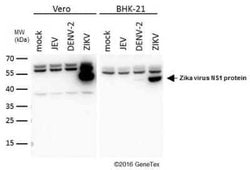 Zika virus (H/PF/2013) NS1 Antibody, Novus Biologicals 100 &mu;g | Buy Online | Bio-Techne | Fisher Scientific
