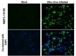 Zika virus NS2B Antibody, Novus Biologicals 100 &mu;g | Buy Online | Novus Biologicals | Fisher Scientific