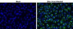 Zika virus NS2B Antibody, Novus Biologicals 100 &mu;g | Buy Online | Novus Biologicals | Fisher Scientific