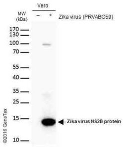 Zika virus NS2B Antibody, Novus Biologicals 100 &mu;g | Buy Online | Novus Biologicals | Fisher Scientific