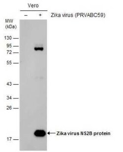 Zika virus NS2B Antibody, Novus Biologicals 100 &mu;g | Buy Online | Novus Biologicals | Fisher Scientific