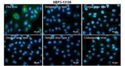 Zika virus NS3 Antibody, Novus Biologicals 100 &mu;g; Unconjugated:Antibodies,