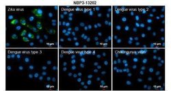 Zika virus NS3 Antibody, Novus Biologicals 100 μg; Unconjugated:Antibodies,