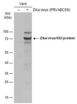 Zika virus NS3 Antibody, Novus Biologicals 100 μg; Unconjugated:Antibodies,