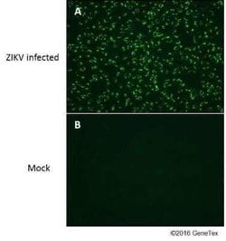 Zika virus NS4B Antibody, Novus Biologicals 100 &mu;g | Buy Online | Novus Biologicals | Fisher Scientific