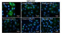 Zika virus NS4B Antibody, Novus Biologicals 100 &mu;g | Buy Online | Novus Biologicals | Fisher Scientific
